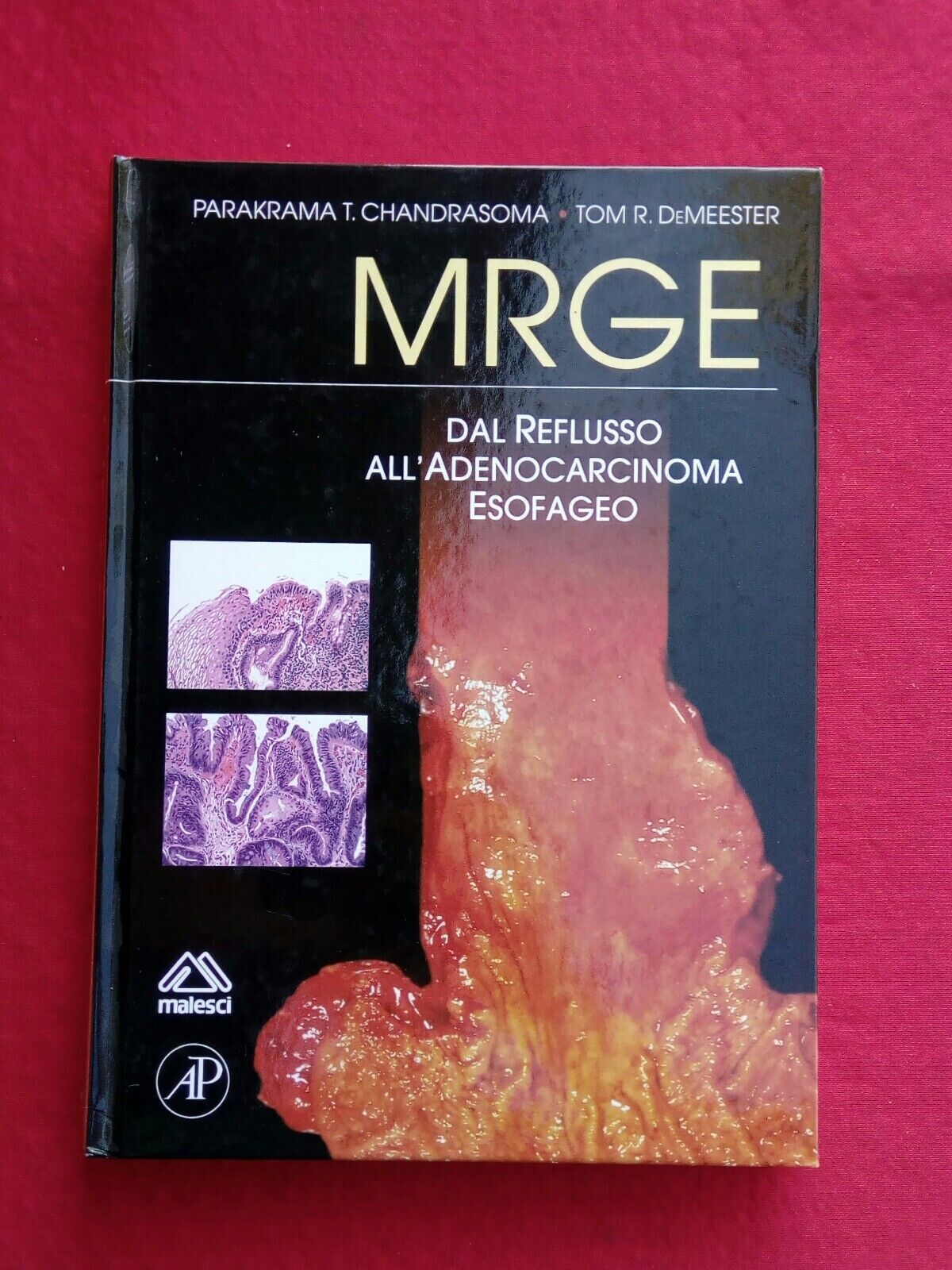 LIBRO, MRGE, Dal reflusso all' adenocarcinoma esofageo, malesci