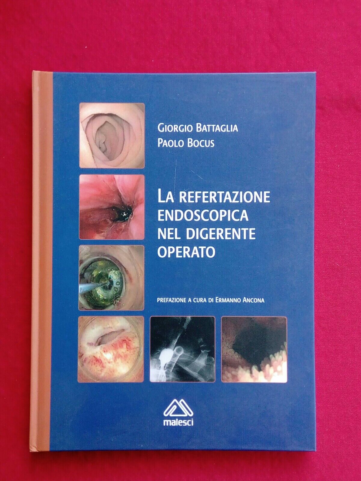 LIBRO, G.Battaglia, P.Bocus, La refertazione endoscopica nel digerente operato